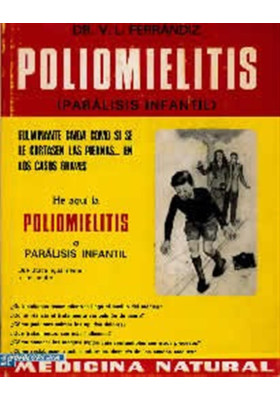 Poliomielitis-Parálisi infantil