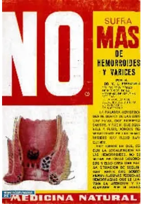 No sufra más de hemorroides y varices