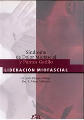 Síndrome del Dolor Miofascial